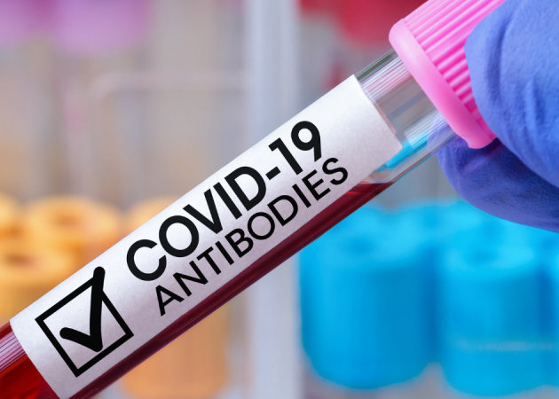 Пред- и поствакцинальные антитела к коронавирусу SARS-CoV-2 IgG (анти-RBD), количественно