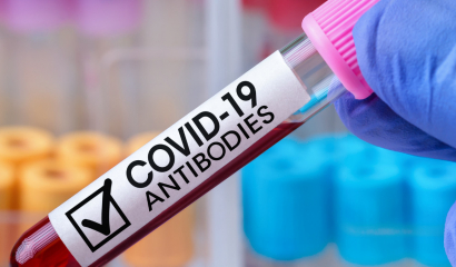 Пред- и поствакцинальные антитела к коронавирусу SARS-CoV-2 IgG (анти-RBD), количественно
