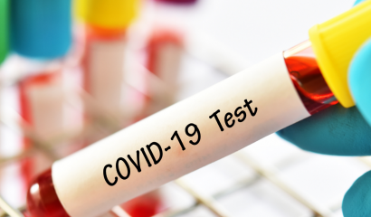 COVID-19: обязательный анализ на антитела перед вакцинацией